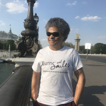 Laurent Gaudens avec le t-shirt de l'association Burns and Smiles